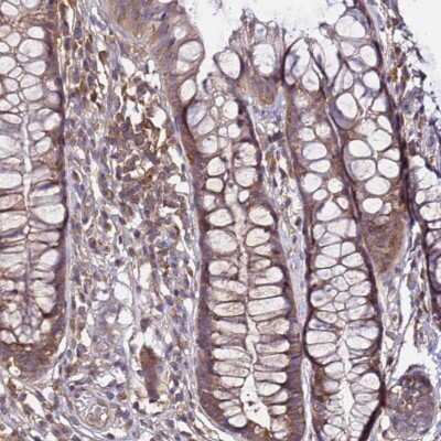 Immunohistochemistry-Paraffin: GSPT2 Antibody [NBP1-91971] - Staining of human rectum shows moderate cytoplasmic positivity in glandular cells.