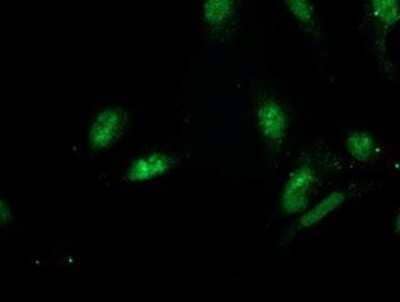 Immunocytochemistry/Immunofluorescence: GSPT2 Antibody (OTI2G9) - Azide and BSA Free [NBP2-71768] - Staining of HeLa cells using anti-GSPT2 mouse monoclonal antibody.