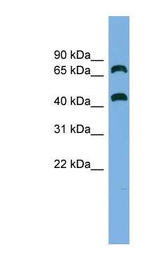 Western Blot GSPT2 Antibody