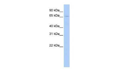 Western Blot: GSPT2 Antibody [NBP2-87532] - WB Suggested Anti-GSPT2 Antibody Titration: 0.2-1 ug/ml. ELISA Titer: 1:62500. Positive Control: MCF7 cell lysate