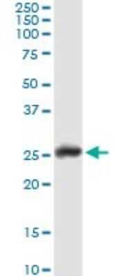 Western Blot: GSTA1 Antibody [H00002938-D01P] - Analysis of GSTA1 expression in human liver.