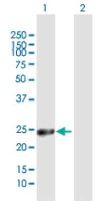 Western Blot: GSTA1 Antibody [H00002938-D01P] - Analysis of GSTA1 expression in transfected 293T cell line by GSTA1 polyclonal antibody.Lane 1: GSTA1 transfected lysate(25.60 KDa).Lane 2: Non-transfected lysate.