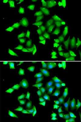 Immunocytochemistry/Immunofluorescence: GSTCD Antibody [NBP3-04623] - Analysis of A549 cells using GSTCD antibody . Blue: DAPI for nuclear staining.