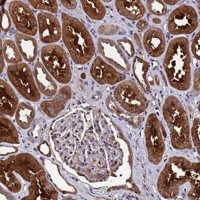 Immunohistochemistry-Paraffin: GSTCD Antibody [NBP1-91972] - Staining of human kidney shows strong cytoplasmic positivity in cells in tubules.
