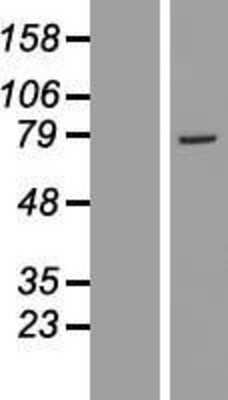 Western Blot: GSTCD Overexpression Lysate (Adult Normal) [NBL1-11370] Left-Empty vector transfected control cell lysate (HEK293 cell lysate); Right -Over-expression Lysate for GSTCD.