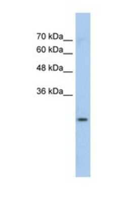 Western Blot: GSTM1 Antibody [NBP1-58377] - This Anti-GSTM1 antibody was used in Western Blot of Jurkat tissue lysate at a concentration of 1ug/ml.