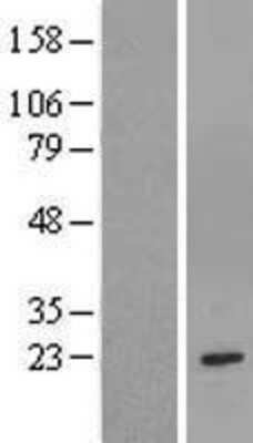 Western Blot Glutathione S-Transferase mu 1/GSTM1 Overexpression Lysate