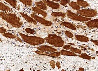 Immunohistochemistry-Paraffin: GSTM2 Antibody (005) [NBP2-90039] - Staining of human GSTM2 in human epididymis with rabbit monoclonal antibody (1:200).