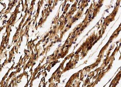 Immunohistochemistry-Paraffin: GSTM2 Antibody (005) [NBP2-90039] - Staining of human GSTM2 in human heart with rabbit monoclonal antibody (1:200).