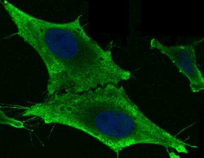 Immunocytochemistry/Immunofluorescence: GSTM2 Antibody (006) [NBP2-90040] - Staining of GSTM2 in Hela cells. Cells were fixed with 4% PFA, permeabilzed with 0.1% Triton X-100 in PBS,blocked with 10% serum, and incubated with rabbit anti-human GSTM2 monoclonal antibody (dilution ratio 1:60) at 4? overnight. Then cells were stained with the Alexa Fluor®488-conjugated Goat Anti-rabbit IgG secondary antibody (green) and counterstained with DAPI (blue).Positive staining was localized to Cytoplasm.