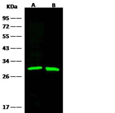 Western Blot: GSTM2 Antibody (006) [NBP2-90040] - Lane A: 293T Whole Cell LysateLane B: 293 Whole Cell LysateLysates/proteins at 30 ug per lane.SecondaryGoat Anti-Rabbit IgG H&L (Dylight800) at 1/10000 dilution.Developed using the Odyssey technique. Performed under reducing conditions.Predicted band size:26 kDaObserved band size:28 kDa