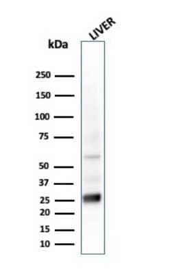 Western Blot: GSTM2 Antibody (CPTC-GSTMu2-2) - Azide and BSA Free [NBP3-08255] - Western Blot Analysis of liver tissue lysate using GSTM2 Mouse Monoclonal Antibody (CPTC-GSTMu2-2).
