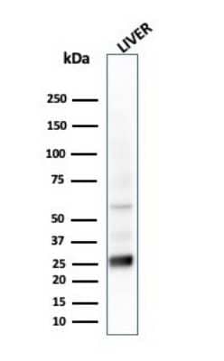 Western Blot: GSTM2 Antibody (CPTC-GSTMu2-2) [NBP3-07346] - Western Blot Analysis of liver tissue lysate using GSTM2 Mouse Monoclonal Antibody (CPTC-GSTMu2-2).