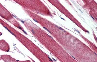 Immunohistochemistry-Paraffin: GSTM2 Antibody [NBP1-55103] - Human Skeletal Muscle lysate tissue at an antibody concentration of 5.0ug/ml.