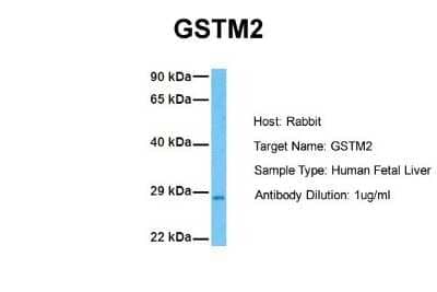 Western Blot: GSTM2 Antibody [NBP1-55103] - Sample Tissue: Human Fetal Liver Antibody Dilution: 1.0 ug/ml