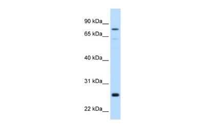 Western Blot: GSTM2 Antibody [NBP1-55103] - Reccomended Titration: 0.2 - 1 ug/ml Positive Control: Human Liver