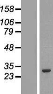 Western Blot: GSTM2 Overexpression Lysate (Adult Normal) [NBL1-11373] Left-Empty vector transfected control cell lysate (HEK293 cell lysate); Right -Over-expression Lysate for GSTM2.