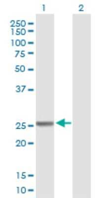 Western Blot: GSTM4 Antibody [H00002948-B01P] - Analysis of GSTM4 expression in transfected 293T cell line by GSTM4 polyclonal antibody.  Lane 1: GSTM4 transfected lysate(23.98 KDa). Lane 2: Non-transfected lysate.