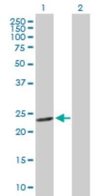 Western Blot: GSTM4 Antibody [H00002948-D01P] - Analysis of GSTM4 expression in transfected 293T cell line by GSTM4 polyclonal antibody.Lane 1: GSTM4 transfected lysate(25.60 KDa).Lane 2: Non-transfected lysate.
