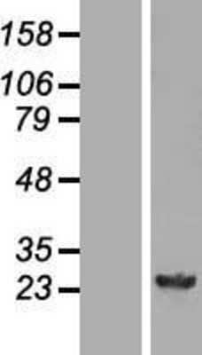 Western Blot GSTM4 Overexpression Lysate