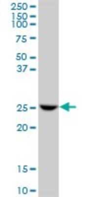 Western Blot: GSTO1 Antibody [H00009446-B01P] - Analysis of GSTO1 expression in Jurkat.