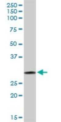 Western Blot: GSTO1 Antibody [H00009446-D01P] - Analysis of GSTO1 expression in human liver.
