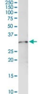 Western Blot: GSTO1 Antibody [H00009446-D01P] - Analysis of GSTO1 expression in mouse stomach.