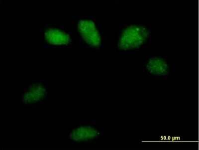 Immunocytochemistry/Immunofluorescence: GSTO2 Antibody [H00119391-B01P] - Analysis of purified antibody to GSTO2 on HeLa cell. (antibody concentration 10 ug/ml)