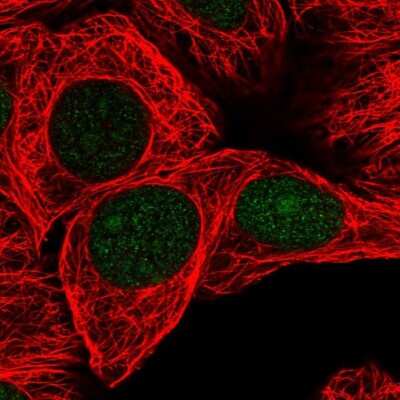 Immunocytochemistry/Immunofluorescence: GSTO2 Antibody [NBP2-14075] - Immunofluorescent staining of human cell line MCF7 shows localization to nucleus & nucleoli.