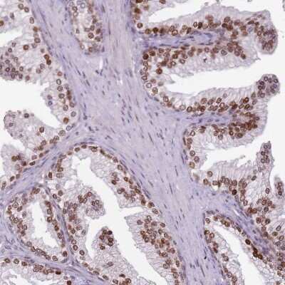 Immunohistochemistry-Paraffin: GSTO2 Antibody [NBP2-14075] - Staining of human prostate shows strong nuclear positivity in glandular cells.