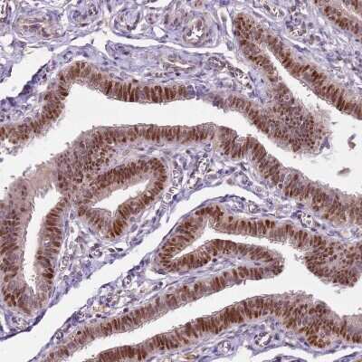 Immunohistochemistry-Paraffin: GSTO2 Antibody [NBP2-14075] - Staining of human fallopian tube shows moderate to strong nuclear positivity in glandular cells.