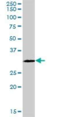 Western Blot: GSTO2 Antibody [H00119391-B01P] - Analysis of GSTO2 expression in COLO 320 HSR.