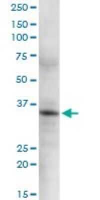 Western Blot: GSTO2 Antibody [H00119391-D01P] - Analysis of GSTO2 expression in HeLa.