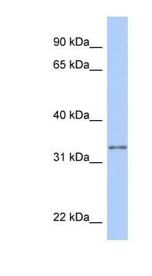 Western Blot: GSTO2 Antibody [NBP1-54580] - Hela cell lysate, concentration 0.2-1 ug/ml.