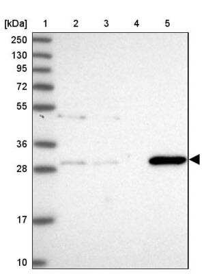 Western Blot: GSTO2 Antibody [NBP2-14075] - Lane 1: Marker  [kDa] 250, 130, 95, 72, 55, 36, 28, 17, 10.  Lane 2: Human cell line RT-4.  Lane 3: Human cell line U-251MG sp.  Lane 4: Human plasma (IgG/HSA depleted).  Lane 5: Human liver tissue