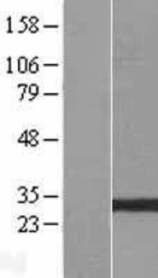 Western Blot: GSTO2 Overexpression Lysate (Adult Normal) [NBL1-11375] Left-Empty vector transfected control cell lysate (HEK293 cell lysate); Right -Over-expression Lysate for GSTO2.