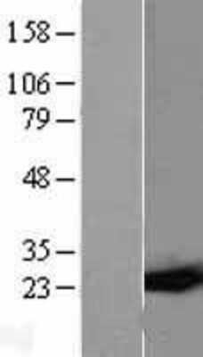 Western Blot: GSTP1 Overexpression Lysate (Adult Normal) [NBL1-11376] Left-Empty vector transfected control cell lysate (HEK293 cell lysate); Right -Over-expression Lysate for GSTP1.