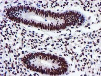 Immunohistochemistry-Paraffin: GSTT2 Antibody (3B6) [NBP2-03126] - Staining of paraffin-embedded Human endometrium tissue using anti-GSTT2 mouse monoclonal antibody.