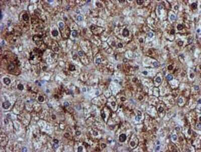 Immunohistochemistry-Paraffin: GSTT2 Antibody (3B6) [NBP2-03126] - Staining of paraffin-embedded Human liver tissue using anti-GSTT2 mouse monoclonal antibody.