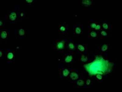 Immunocytochemistry/Immunofluorescence: GSTT2 Antibody (OTI3B6) - Azide and BSA Free [NBP2-70861] - Staining of COS7 cells transiently transfected by pCMV6-ENTRY GSTT2.