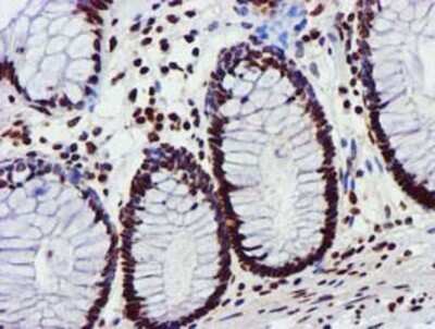 Immunohistochemistry: GSTT2 Antibody (OTI3B6) - Azide and BSA Free [NBP2-70861] - Staining of paraffin-embedded Human colon tissue using anti-GSTT2 mouse monoclonal antibody.