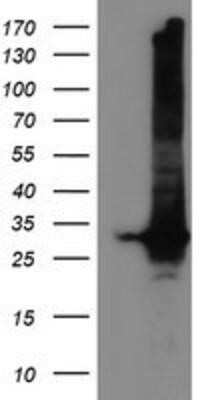 Western Blot: GSTT2 Antibody (OTI3B6) - Azide and BSA Free [NBP2-70861] - HEK293T cells were transfected with the pCMV6-ENTRY control (Left lane) or pCMV6-ENTRY GSTT2 (Right lane) cDNA for 48 hrs and lysed. Equivalent amounts of cell lysates (5 ug per lane) were separated by SDS-PAGE and immunoblotted with anti-GSTT2.