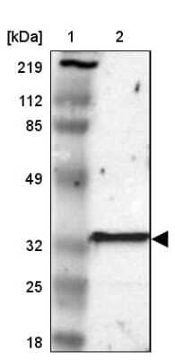 Western Blot: GSTT2B Antibody [NBP1-86186] - Lane 1: Marker  [kDa] 219, 112, 85, 49, 32, 25, 18.   Lane 2: Human cell line RT-4