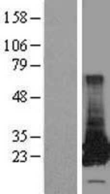 Western Blot: GSTT2 Overexpression Lysate (Adult Normal) [NBL1-11378] Left-Empty vector transfected control cell lysate (HEK293 cell lysate); Right -Over-expression Lysate for GSTT2.