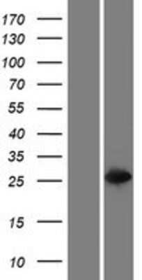 Western Blot: GSTT2B Overexpression Lysate [NBP2-10660] - Left-Empty vector transfected control cell lysate (HEK293 cell lysate); Right -Over-expression Lysate for GSTT2B.