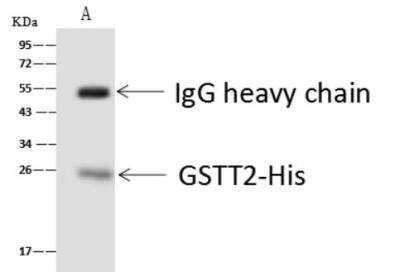 Immunoprecipitation: GSTT2B Antibody [NBP3-06612] - Lane A:0.5 mg Rat lung tissue Lysate 4 uL anti-GSTT2 rabbit polyclonal antibody and 60 ug of Immunomagnetic beads Protein A/G. Primary antibody: Anti-GSTT2 rabbit polyclonal antibody,at 1:100 dilution Secondary antibody: Goat Anti-Rabbit IgG (H+L)/HRP at 1/10000 dilution Developed using the ECL technique. Performed under reducing conditions. Predicted band size: 27 kDa Observed band size :25 kDa