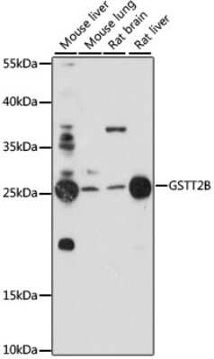 Western Blot: GSTT2B Antibody [NBP3-04458] - Analysis of extracts of various cell lines, using GSTT2B antibody at 1:1000 dilution. Secondary antibody: HRP Goat Anti-Rabbit IgG (H+L) at 1:10000 dilution. Lysates/proteins: 25ug per lane. Blocking buffer: 3% nonfat dry milk in TBST. Detection: ECL Basic Kit
