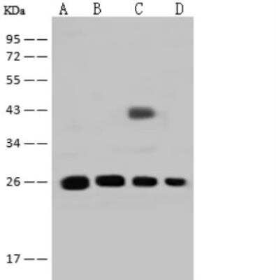 Western Blot: GSTT2B Antibody [NBP3-06612] - Lane A: Rat kidney tissue lysate Lane B: Rat lung tissue lysate Lane C: Rat pancreas tissue lysate Lane D: Mouse lung tissue lysate Lysates/proteins at 30 ug per lane. Secondary Goat Anti-Rabbit IgG (H+L)/HRP at 1/10000 dilution. Developed using the ECL technique. Performed under reducing conditions. Predicted band size:27 kDa Observed band size:27 kDa