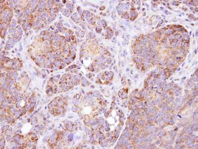 Immunohistochemistry-Paraffin: GSTZ1 Antibody [NBP1-33693] - Paraffin-embedded SW480 xenograft, using antibody at 1:100 dilution.