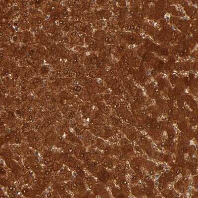 Immunohistochemistry-Paraffin: GSTZ1 Antibody [NBP1-83320] - Staining of human liver shows strong cytoplasmic and nuclear positivity in hepatocytes.